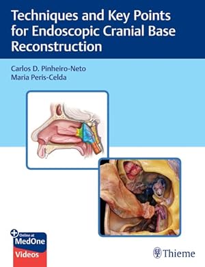 Seller image for Techniques and Key Points for Endoscopic Cranial Base Reconstruction for sale by GreatBookPrices