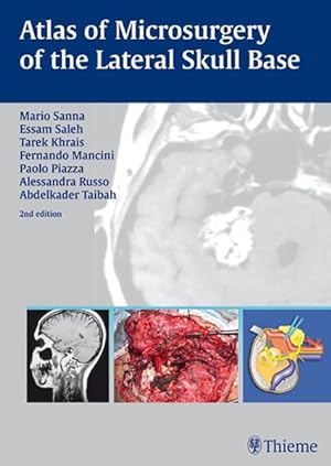 Bild des Verkufers fr Atlas of Microsurgery of the Lateral Skull Base zum Verkauf von GreatBookPrices