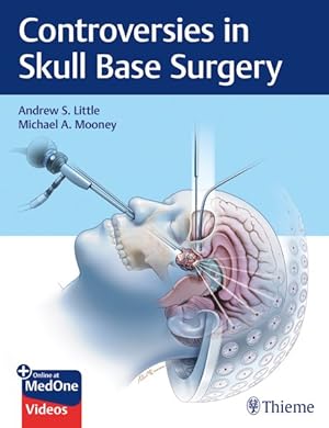 Bild des Verkufers fr Controversies in Skull Base Surgery zum Verkauf von GreatBookPrices