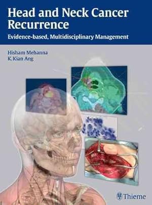 Seller image for Head and Neck Cancer Recurrence : Evidence-Based, Multidisciplinary Management for sale by GreatBookPrices