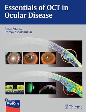 Seller image for Essentials of OCT in Ocular Disease for sale by GreatBookPrices