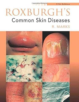 Seller image for Roxburgh's Common Skin Diseases, 17Ed for sale by WeBuyBooks