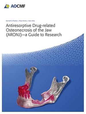 Bild des Verkufers fr Antiresorptive Drug-Related Osteonecrosis of the Jaw : ARONJ - a Guide to Research zum Verkauf von GreatBookPricesUK