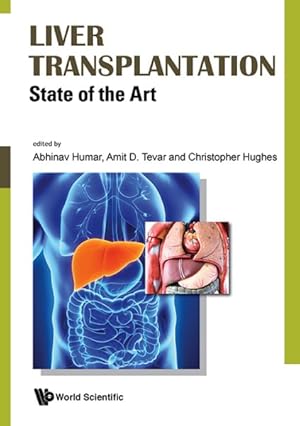 Imagen del vendedor de Liver Transplantation : State of the Art a la venta por GreatBookPricesUK