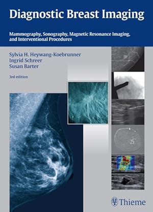 Image du vendeur pour Diagnostic Breast Imaging : Mammography, Sonography, MRI and Interventional Procedures mis en vente par GreatBookPricesUK