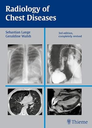 Seller image for Radiology of Chest Diseases for sale by GreatBookPricesUK