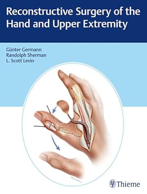 Seller image for Reconstructive Surgery of the Hand and Upper Extremity for sale by GreatBookPricesUK