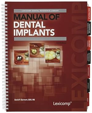 Bild des Verkufers fr Manual of Dental Implants Spiral-bound zum Verkauf von booksXpress