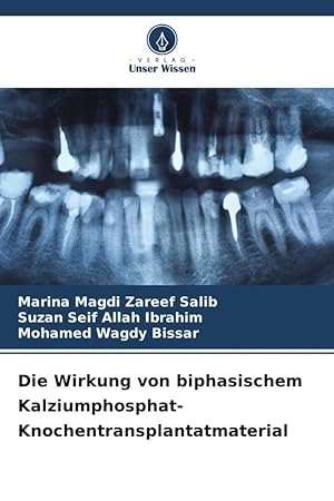 Seller image for Die Wirkung von biphasischem Kalziumphosphat-Knochentransplantatmaterial for sale by moluna