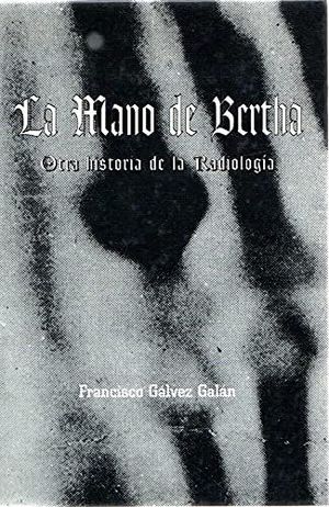 LA MANO DE BERTHA