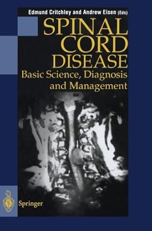 Imagen del vendedor de Spinal Cord Disease: Basic Science, Diagnosis and Management by Andrew Eisen, Edmund Critchley [Paperback ] a la venta por booksXpress