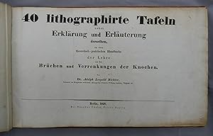 40 lithographirte Tafeln nebst Erklärung und Erläuterung derselben, zu dem theoretisch-praktische...