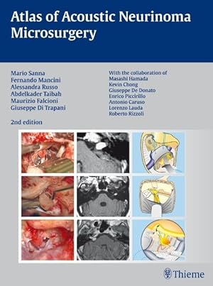 Bild des Verkufers fr Atlas of Acoustic Neurinoma Microsurgery zum Verkauf von moluna