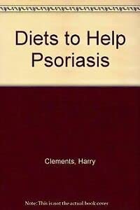 Bild des Verkufers fr Psoriasis (Diets to Help S.) zum Verkauf von WeBuyBooks