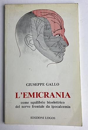 L'emicrania. Come squilibrio bioelettrico del nervo frontale da ipocalcemia