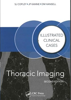 Image du vendeur pour Thoracic Imaging mis en vente par GreatBookPrices