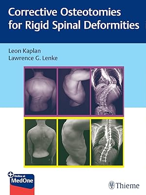 Immagine del venditore per Corrective Osteotomies for Rigid Spinal Deformities venduto da moluna