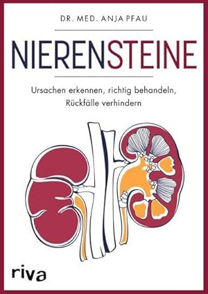 Seller image for Nierensteine - Ursachen erkennen, richtig behandeln, Rckflle verhindern for sale by BuchWeltWeit Ludwig Meier e.K.