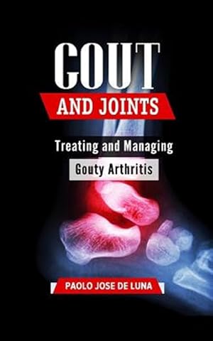 Image du vendeur pour Gout and Joints : Treating and Managing Gouty Arthritis mis en vente par GreatBookPrices