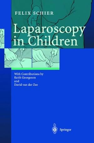 Bild des Verkufers fr Laparoscopy in Children by Schier, Felix [Paperback ] zum Verkauf von booksXpress