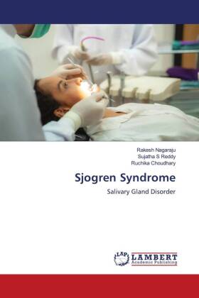 Seller image for Sjogren Syndrome for sale by moluna
