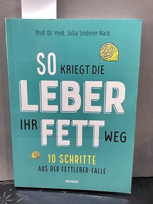 Seller image for So kriegt die Leber ihr Fett weg! : 10 Schritte aus der Fettleber-Falle. Prof. Dr. med. for sale by Kepler-Buchversand Huong Bach