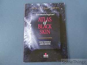 Dermatological Atlas of Black Skin