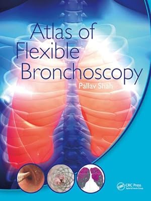 Seller image for Atlas of Flexible Bronchoscopy for sale by AHA-BUCH GmbH