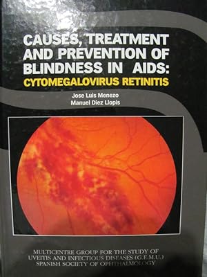 Imagen del vendedor de CAUSES, TREATMENT AND PREVENTION OF BLINDNESS IN AIDS: CYTOMEGALOVIRUS RETINITIS. a la venta por buchlando-buchankauf