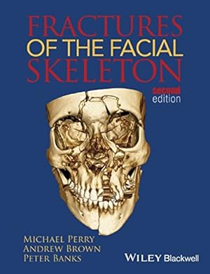 Imagen del vendedor de Fractures of the Facial Skeleton by Perry, Michael, Brown, Andrew, Banks, Peter [Paperback ] a la venta por booksXpress