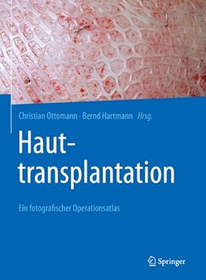 Bild des Verkufers fr Hauttransplantation : Ein fotografischer Operationsatlas zum Verkauf von AHA-BUCH GmbH