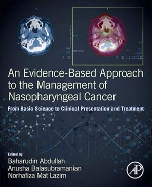 Seller image for An Evidence-Based Approach to the Management of Nasopharyngeal Cancer : From Basic Science to Clinical Presentation and Treatment for sale by AHA-BUCH GmbH