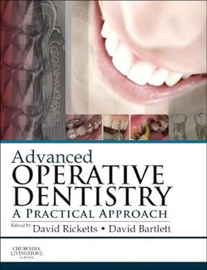Imagen del vendedor de Advanced Operative Dentistry : A Practical Approach a la venta por AHA-BUCH GmbH