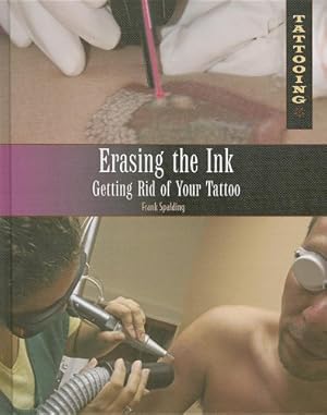 Bild des Verkufers fr Erasing the Ink: Getting Rid of Your Tattoo (Tattooing) zum Verkauf von WeBuyBooks