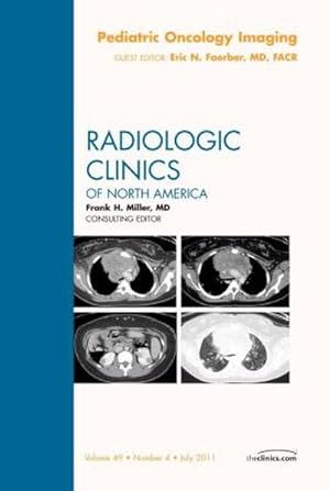 Seller image for Pediatric Oncology Imaging, An Issue of Radiologic Clinics of North America for sale by AHA-BUCH GmbH