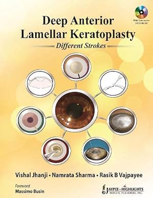 Seller image for Deep Anterior Lamellar Keratoplasty Different Strokes (Hardcover) for sale by CitiRetail