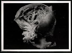 Fotografie menschliches Herz, Organ in Schnittdarstellung, Herzkammer