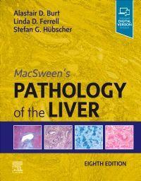 Seller image for Macsween\ s Pathology of the Liver for sale by moluna
