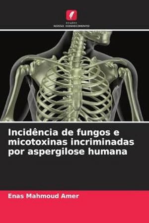 Seller image for Incidncia de fungos e micotoxinas incriminadas por aspergilose humana for sale by AHA-BUCH GmbH