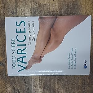 Seller image for Todo sobre varices for sale by Libros nicos