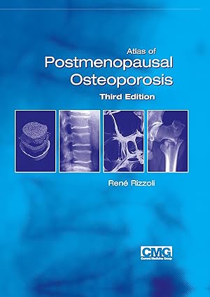 Bild des Verkufers fr Atlas of Postmenopausal Osteoporosis zum Verkauf von moluna