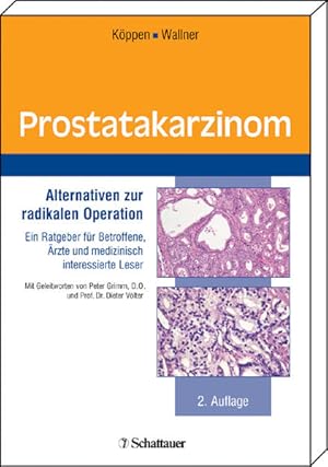 Seller image for Prostatakarzinom: Alternativen zur radikalen Operation. Ein Ratgeber fr Betroffene, rzte und medizinisch interessierte Leser for sale by Gerald Wollermann