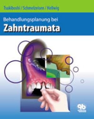 Seller image for Behandlungsplanung bei Zahntraumata for sale by Studibuch
