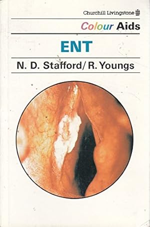 Seller image for ENT (Colour Aids) for sale by WeBuyBooks