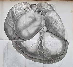 Traité clinique des maladies du coeur, précédé de recherches nouvelles sur l'anatomie et la physi...