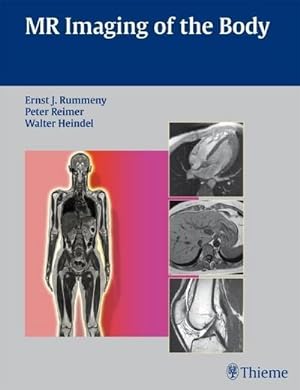 Image du vendeur pour MR Imaging of the Body mis en vente par CSG Onlinebuch GMBH
