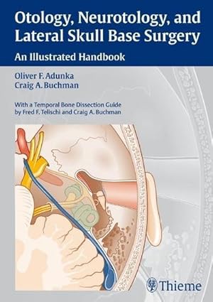 Image du vendeur pour Otology, Neurotology, and Lateral Skull-Base Surgery:: An Illustrated Handbook mis en vente par CSG Onlinebuch GMBH