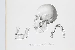 Crâne remarquable d'un Botocude / Les Indiens en route - Voyage au Brésil, Dans les années 1815, ...