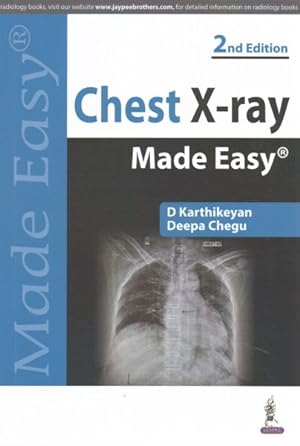 Bild des Verkufers fr Chest X-Ray Made Easy zum Verkauf von GreatBookPricesUK