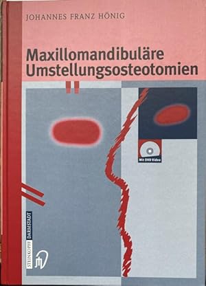 Immagine del venditore per Maxillomandibulre Umstellungsosteotomien. Mit 113 berwiegend farbigen Abbildungen und DVD Video. venduto da Treptower Buecherkabinett Inh. Schultz Volha